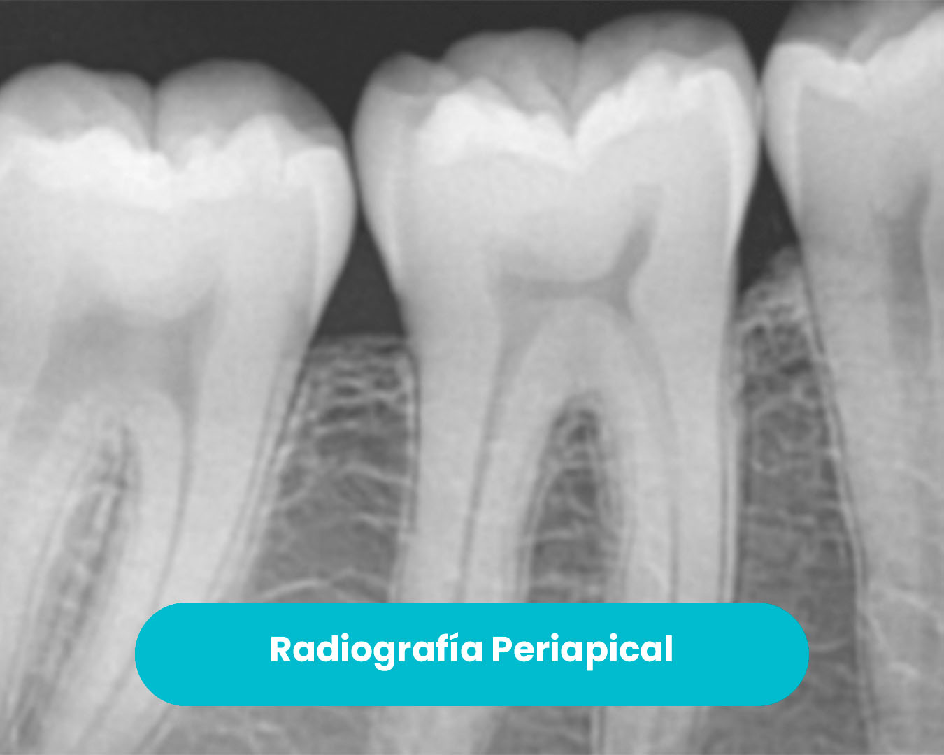 radio-periop2
